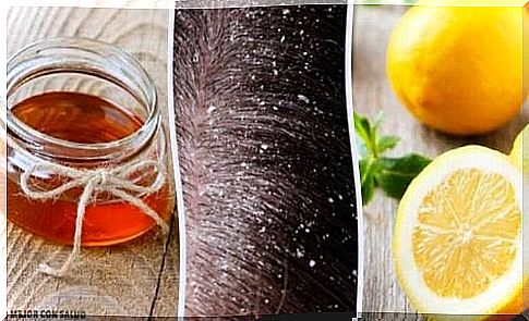 10 effective natural remedies for dandruff