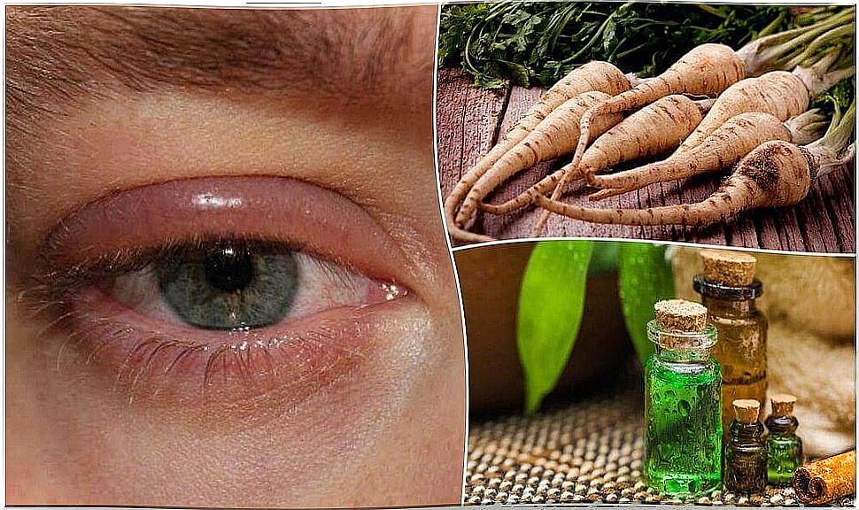 5 home treatments to relieve swollen eyelids