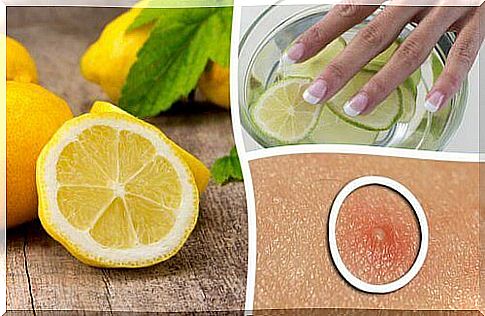 6 ways to use lemons for beauty