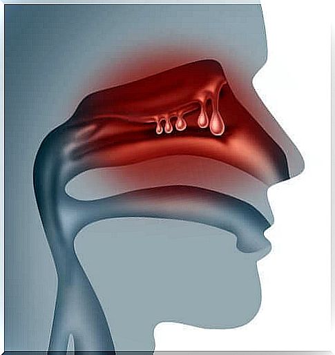 Administration of medications through the nose works well for patients who have difficulty swallowing.