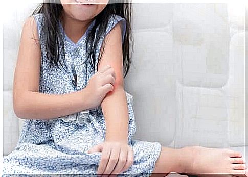 Advice for managing psoriasis in children