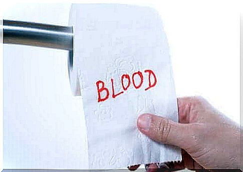 Bleeding in the rectum: Why does it happen?