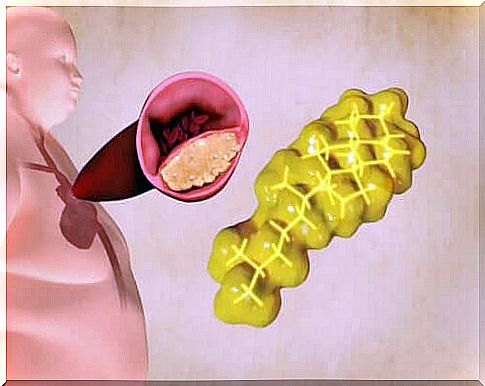 An obese person with a high content of triglycerides.