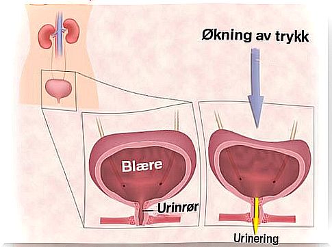 Exercises for urinary incontinence in women