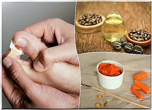 Get rid of hanging nails with 8 natural treatments