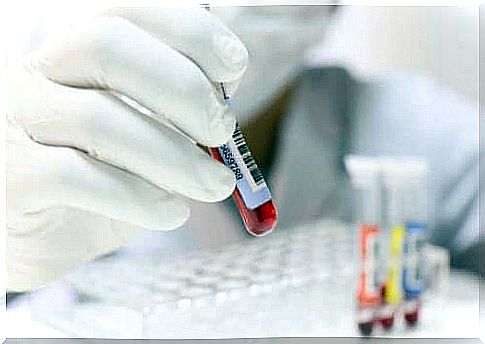 Taking blood samples are some of the easiest tests you can do. 