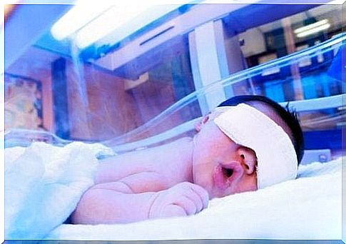 treatment of jaundice in infants