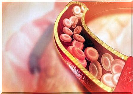 Cholesterol