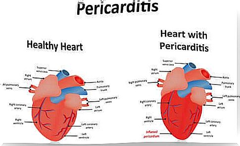 A comparison of a healthy heart vs a sick heart.