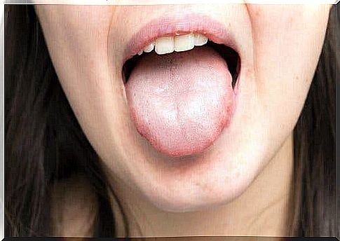 Woman with thick saliva.