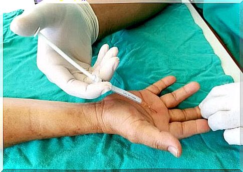 injection in the hand done by a third party