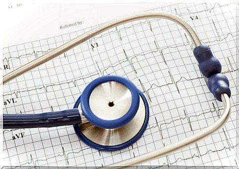 What is arrhythmia?  Picture of medical instruments