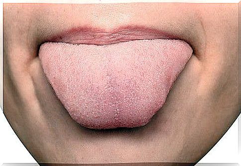 What the marks on your tongue can mean